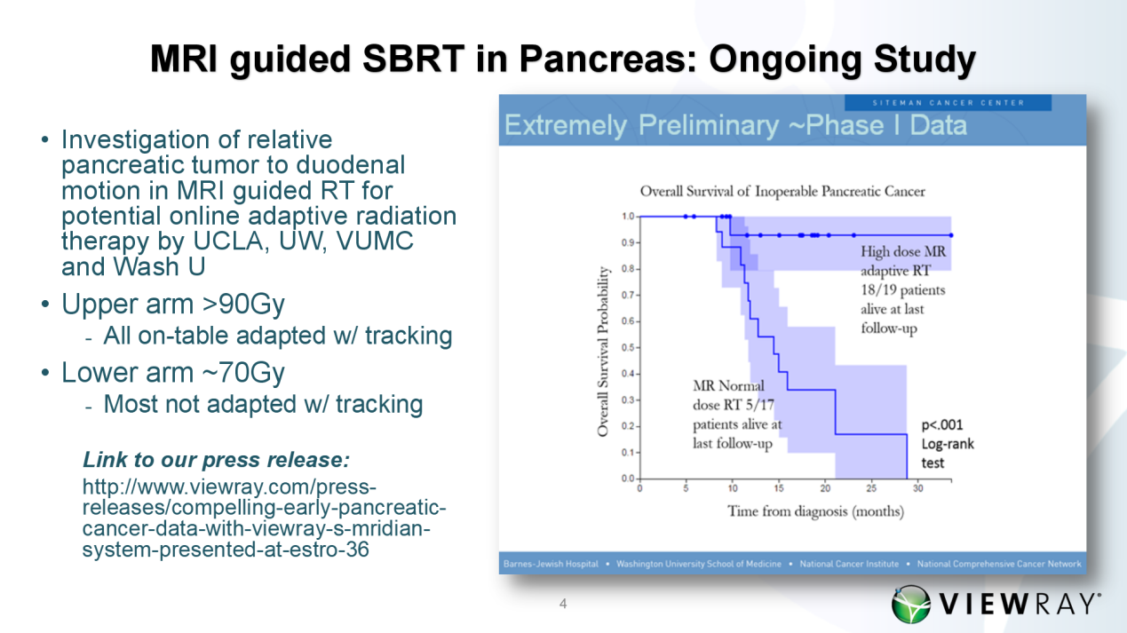 ViewRay核磁引导放疗系统治疗不可切除的胰腺癌在本届2017-ESTR0大会上大放异彩